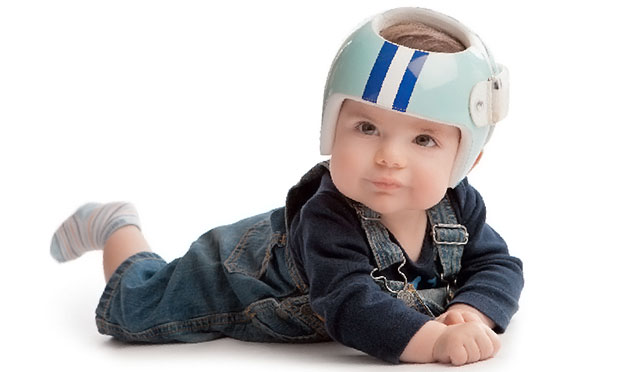 Assimetria craniana: como corrigir a cabeça torta do bebê | CLAUDIA