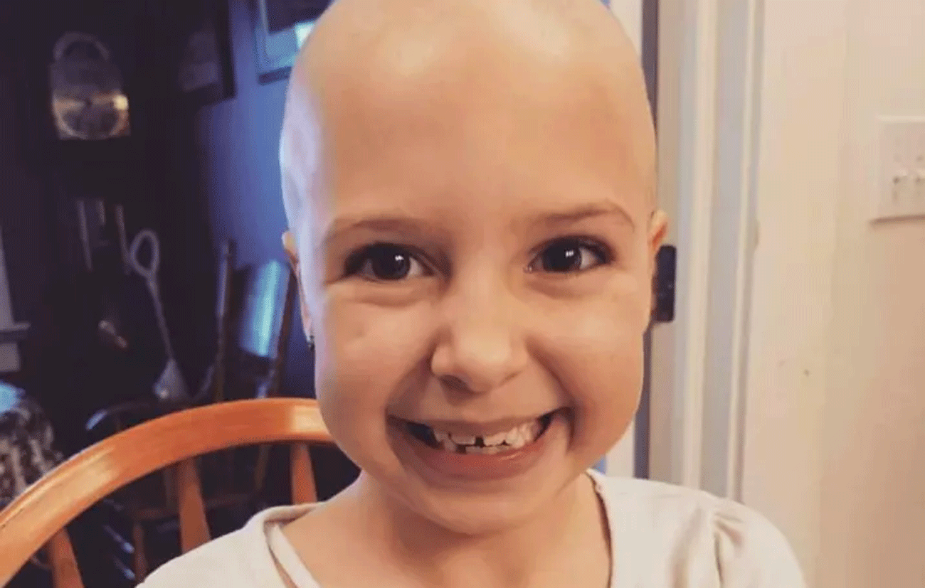Garotinha De 7 Anos Com Alopecia Fica Careca E Continua Arrasando Claudia