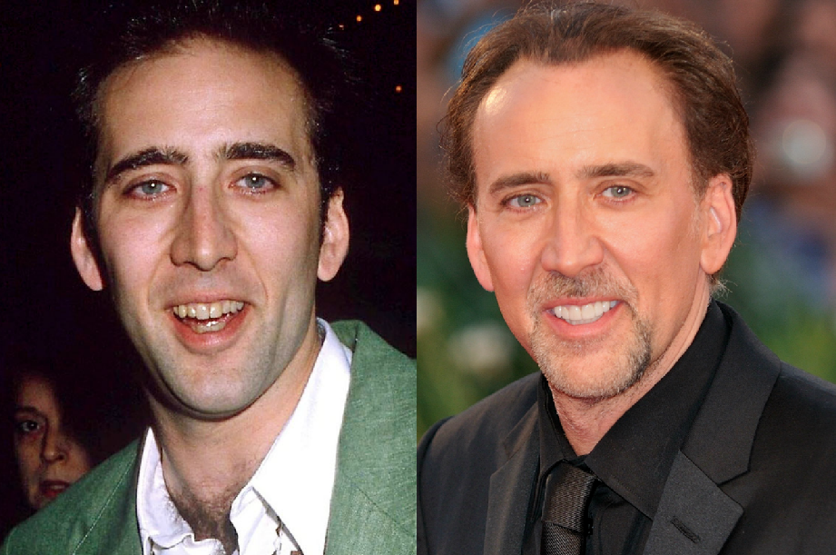 nicolas-cage-antes-depois