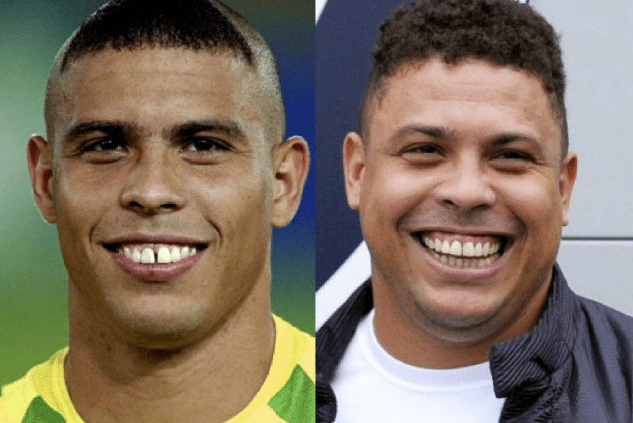 ronaldo-antes-depois