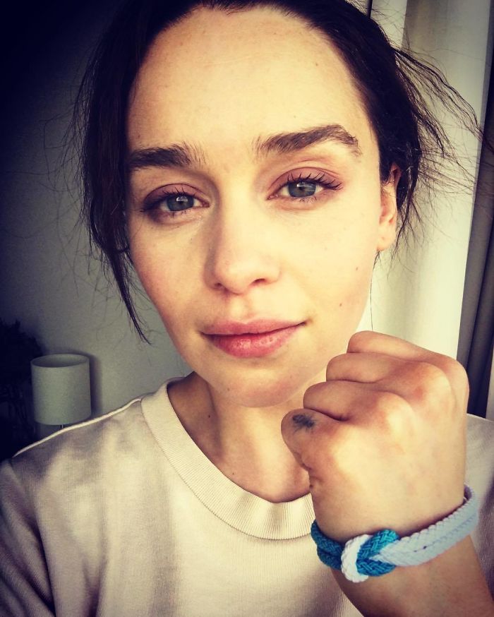 emilia clarke sofre aneurisma