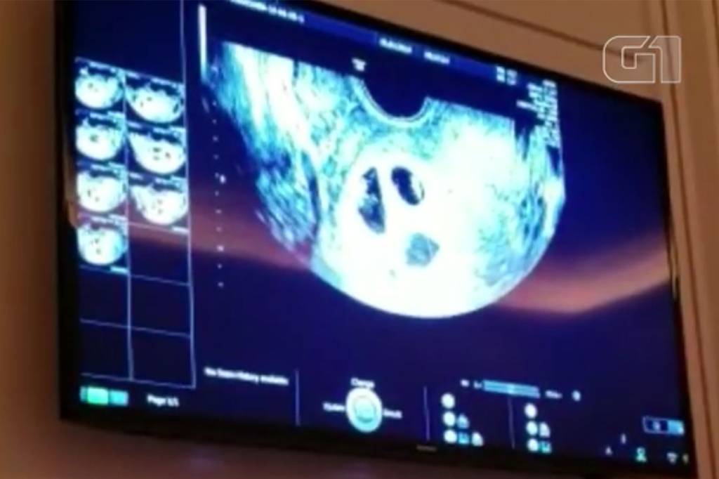 ultrassom2 ultrassom2