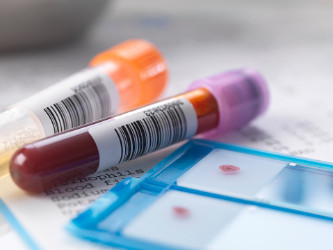Tubo de sangue - teste de HIV