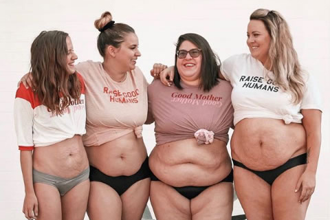 Mulheres mostram a realidade e a beleza do corpo pós-parto