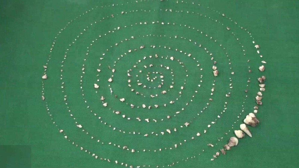 Garoto tem 526 dentes retirados da boca