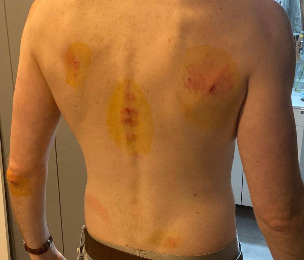 agressão homofóbica em portugal agressão homofóbica em portugal