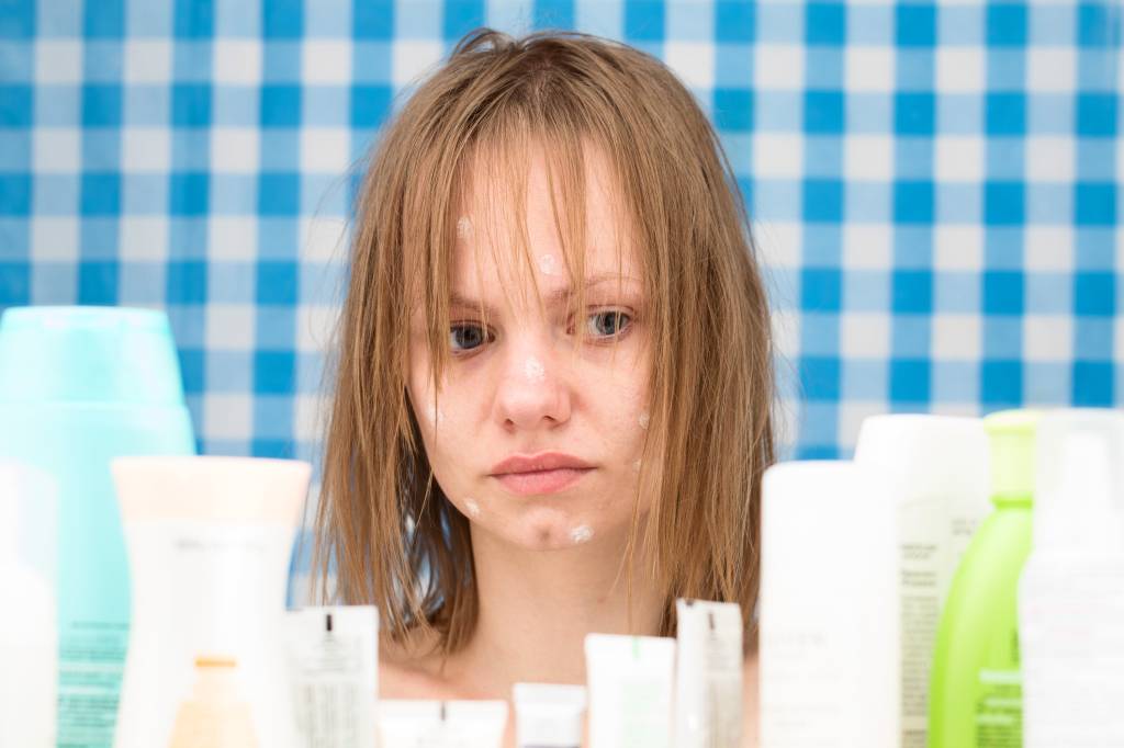 Acne x autoconfiança: a saúde da pele pode interferir na saúde mental Acne x autoconfiança: a saúde da pele pode interferir na saúde mental
