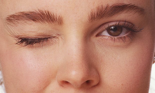 Pele incrível: saiba como diminuir as olheiras em 30 dias