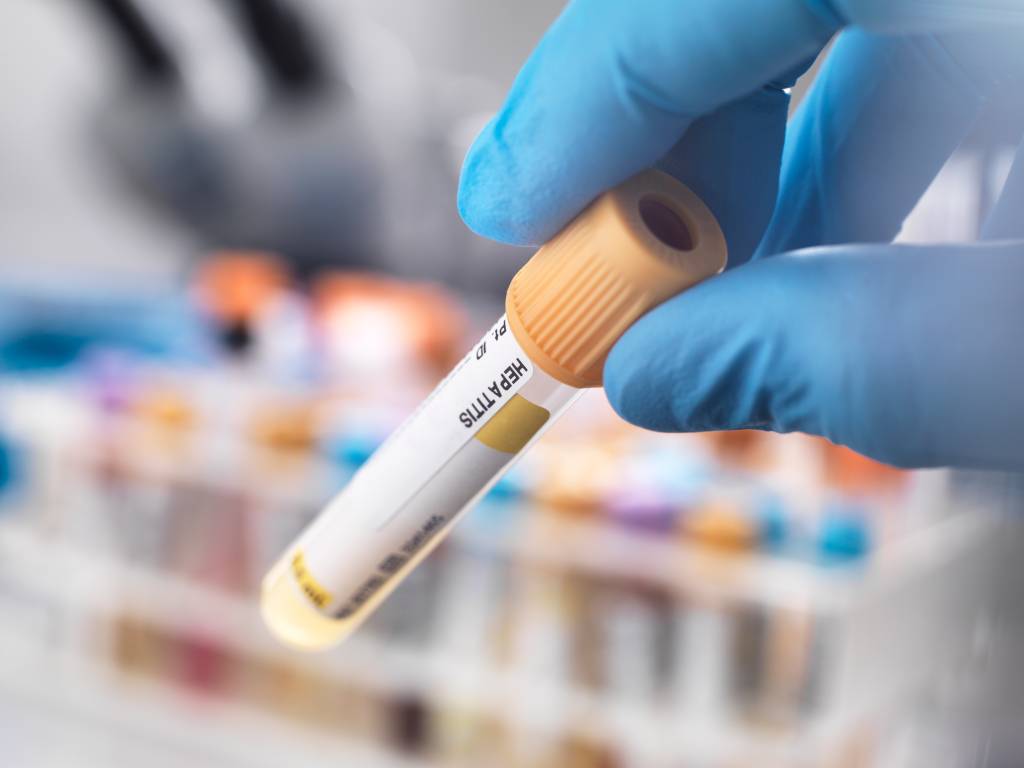 Hepatite C: terminais e estações de metrô de SP oferecem teste gratuito