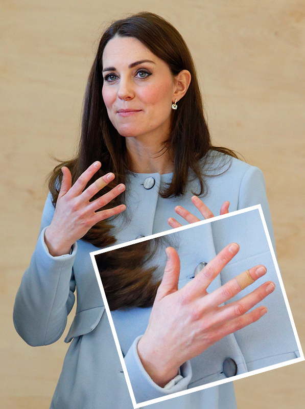 Kate Middleton curativos nas mãos Kate Middleton curativos nas mãos