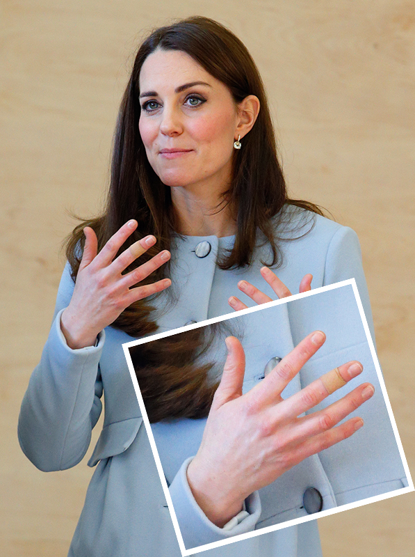 Kate Middleton curativos nas mãos