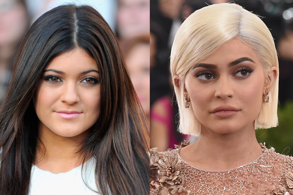 Kylie Jenner - antes e depois
