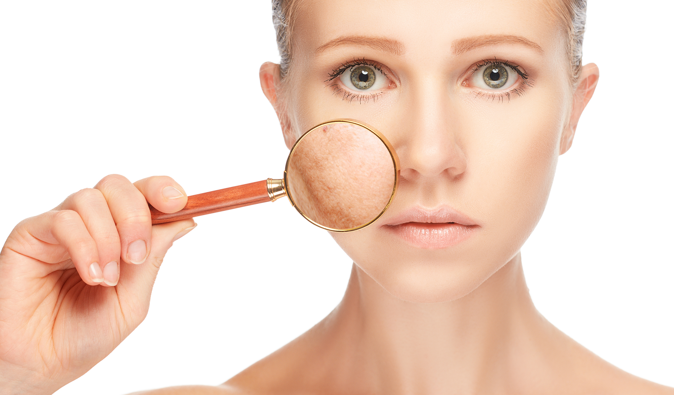 laser-treatment-for-melasma-captions-trendy