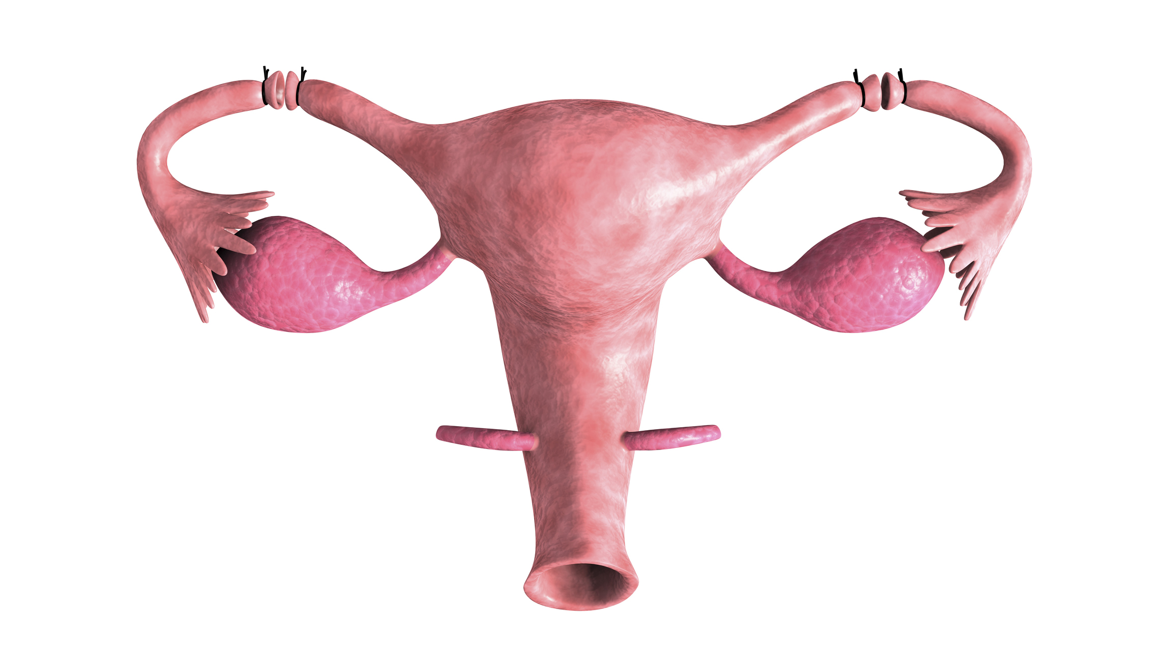 Cirurgia Geral Goiânia - Você sabe o que é laqueadura tubária?