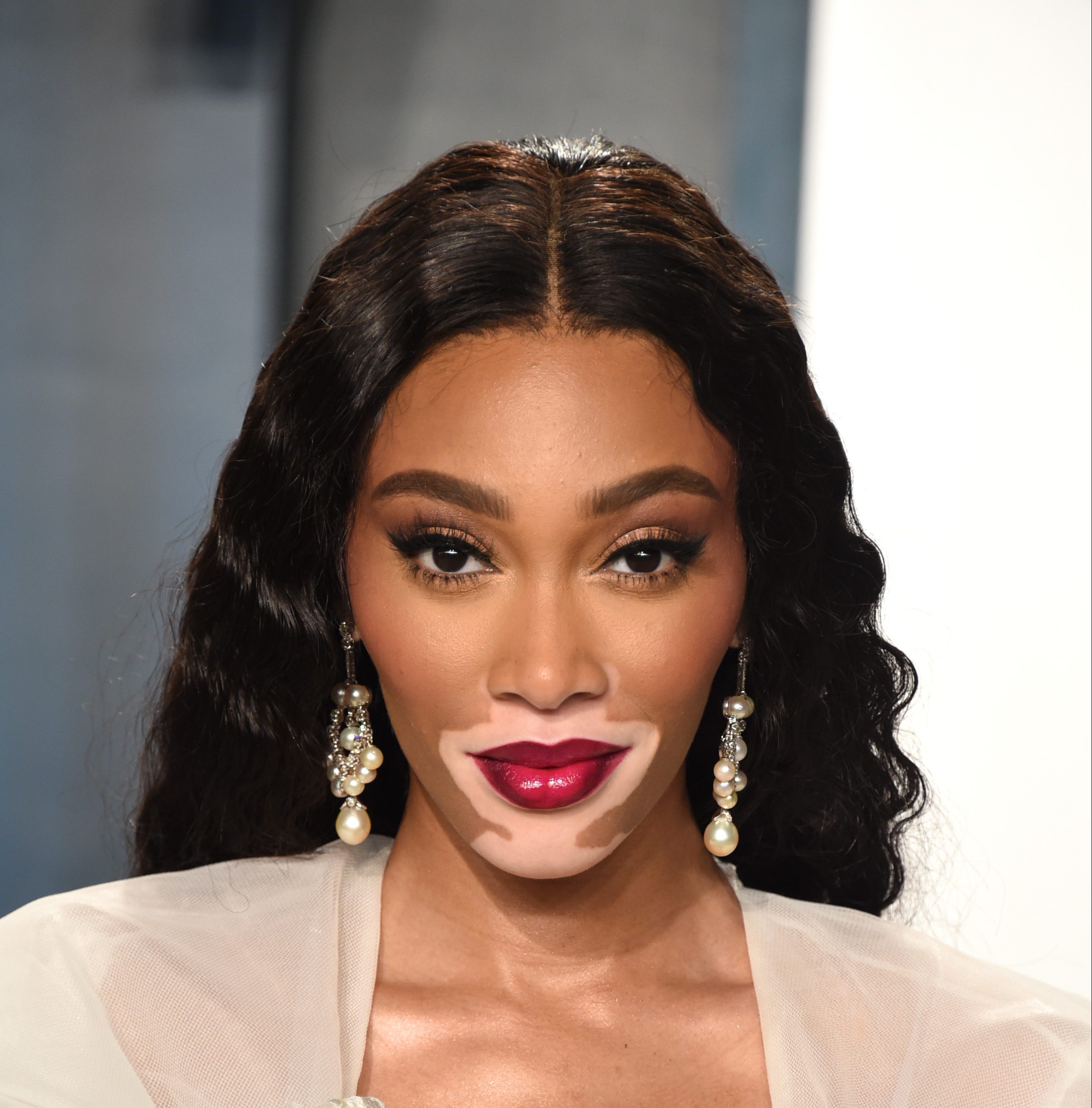 Winnie Harlow: A mulher que quebrou os padrões de beleza das grifes de luxo  | CLAUDIA