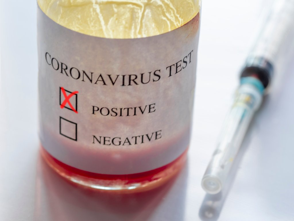 coronavírus positivo