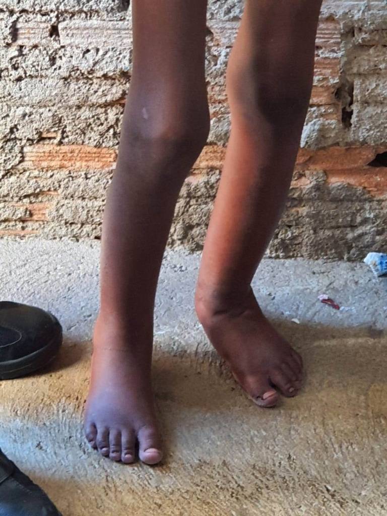 criança presa em barril Menino de 11 anos encontrado preso em barril de ferro