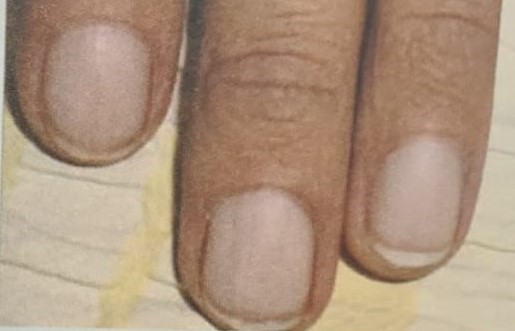 Unha 3 unha