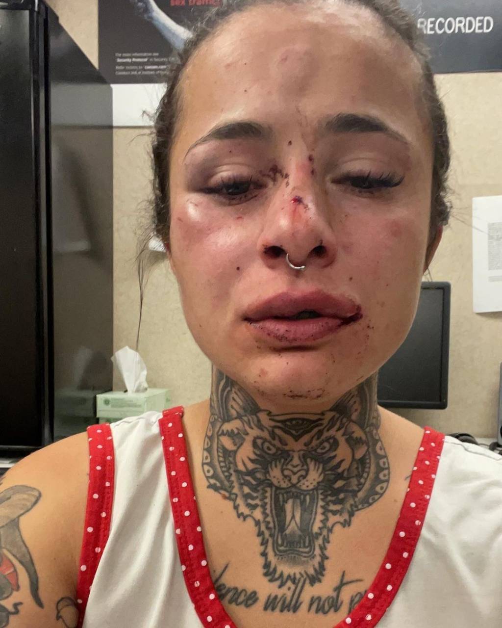 Espancada pelo namorado nos EUA, brasileira pede socorro pelo Instagram