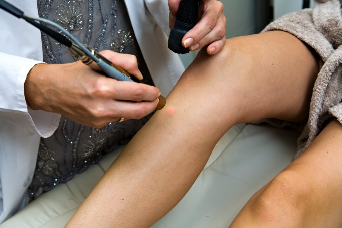 Dermatologist performs laser hair removal