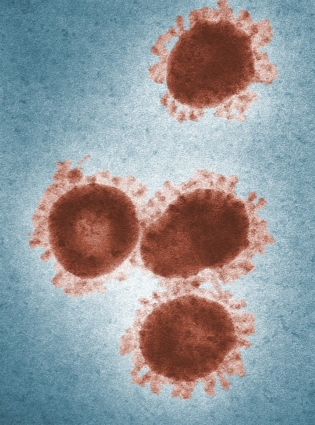 Ilustração de vírus desconhecido.