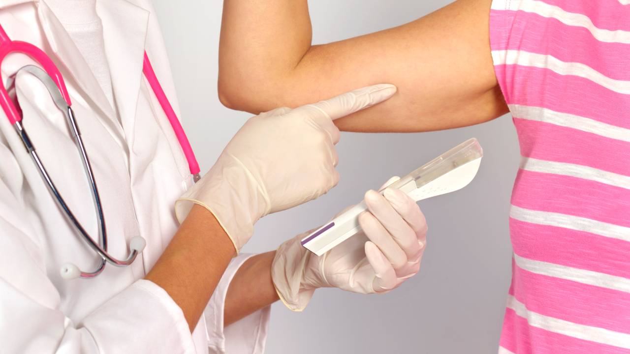 implantes hormonais - chip da beleza