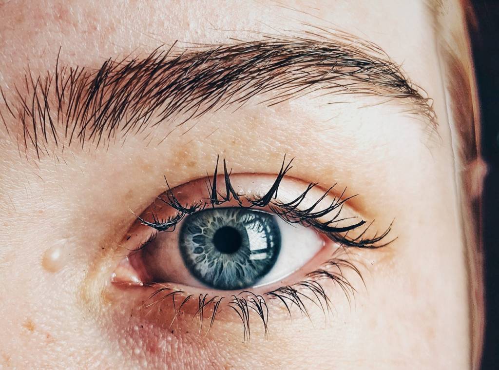 Lifting de sobrancelhas com botox; tudo o que você precisa saber