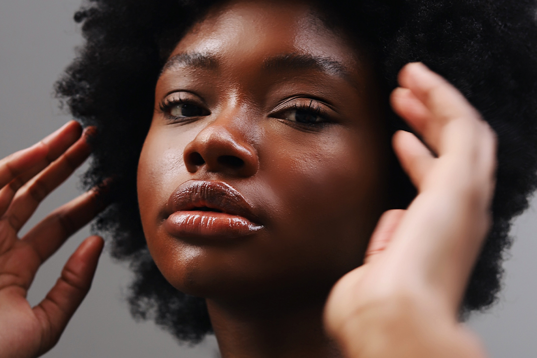 Melasma: Cuidados com a pele negra