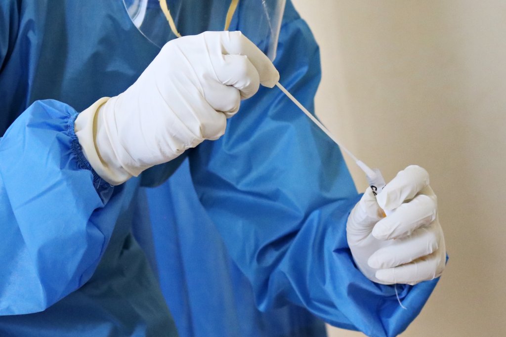 teste-positivos-crescem-Covid19-variante-Éris Médico manuseando um teste PCR
