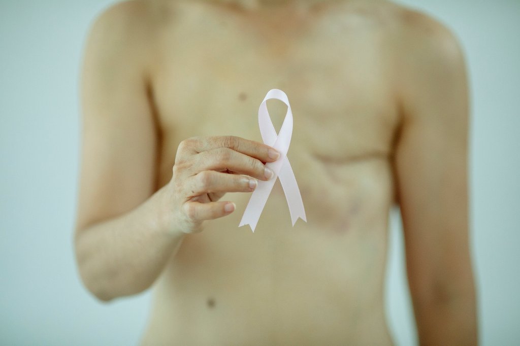 Mulher mastomizada segurando símbolo da luta contra o câncer de mama