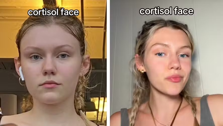 Antes e depois do cortisolface