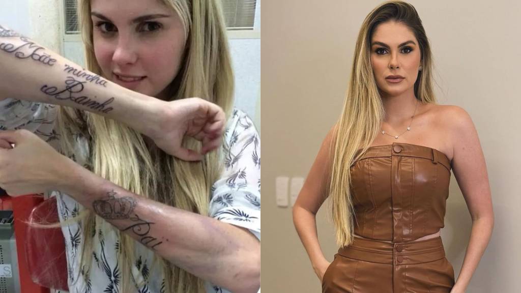 Tatuagem está fora de moda? Conheça 5 famosos que removeram as suas