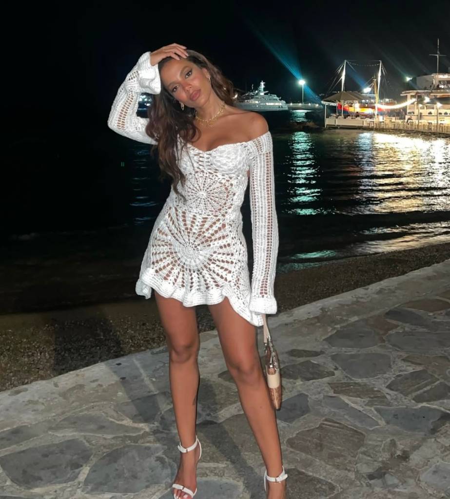 anitta-procedimento-estético Quero remover a veia da testa. E agora?