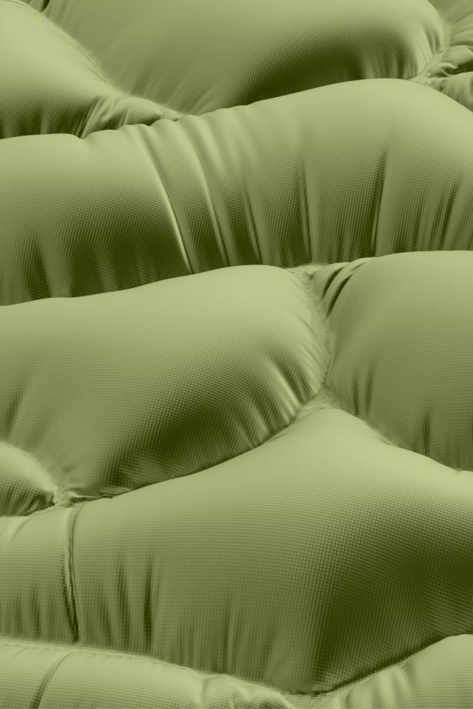 Lipedema Caracterizado pelo acúmulo anormal de células adiposas em áreas específicas, como quadris, braços e pernas, o lipedema provoca um desajuste nas proporções corporais e pode causar sintomas incômodos