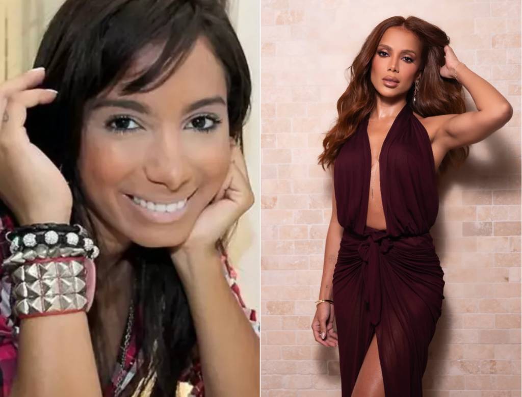 celebridades-antes-depois-anitta Anitta antes e depois da fama