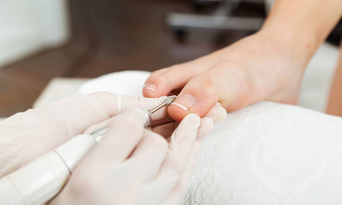 Tratamento contra fungos nas unhas dos pés leva de 6 a 12 meses em média