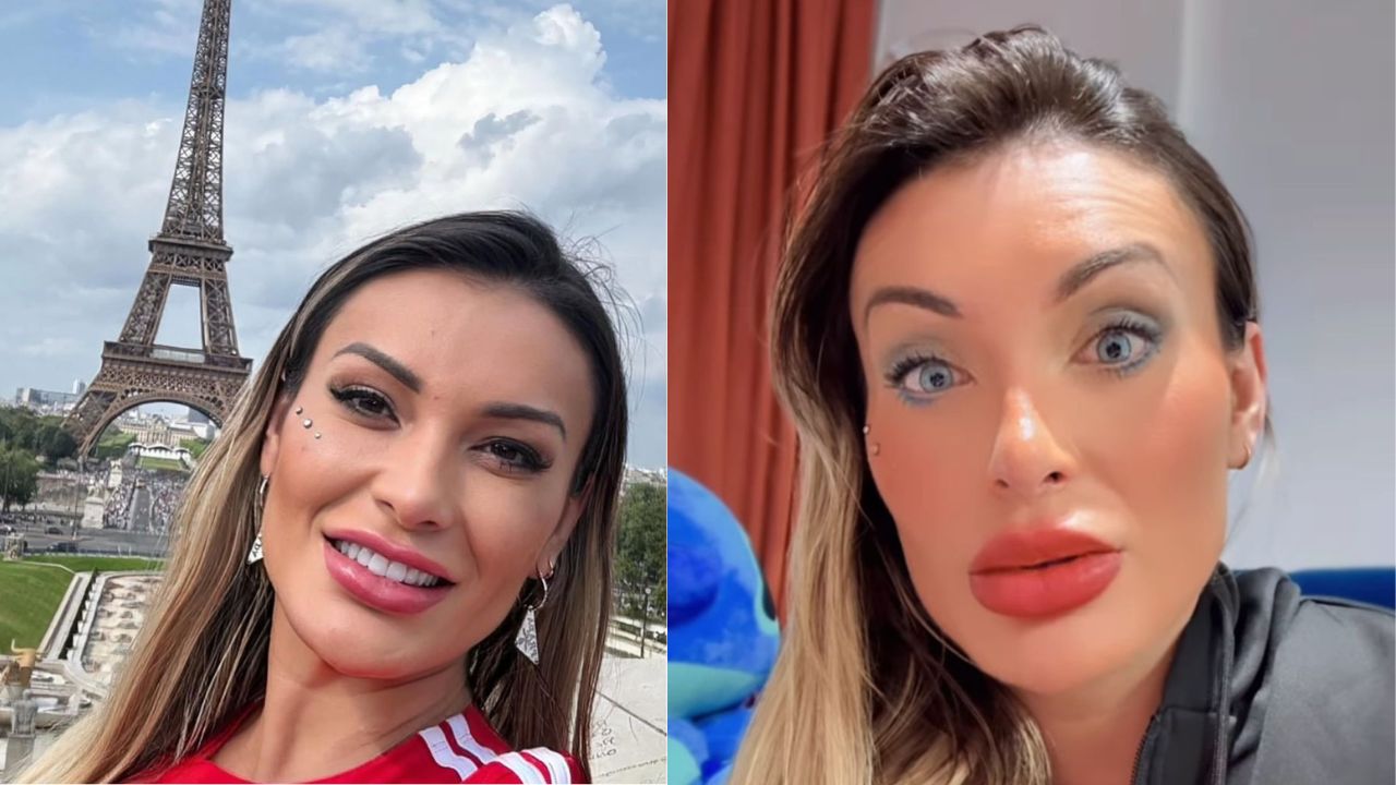 Imagem mostra antes e depois de Andressa Urach após cirurgia nos olhos.