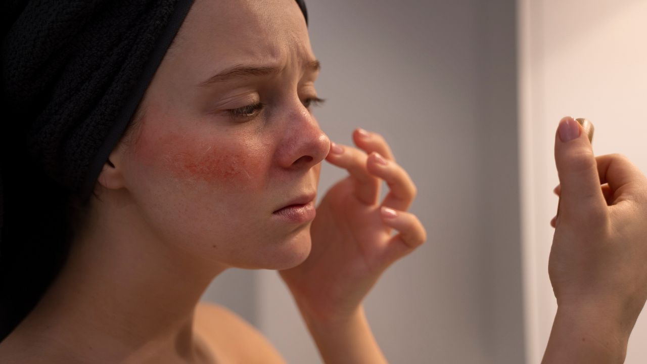 Imagem de mulher olhando sua rosácea no espelho
