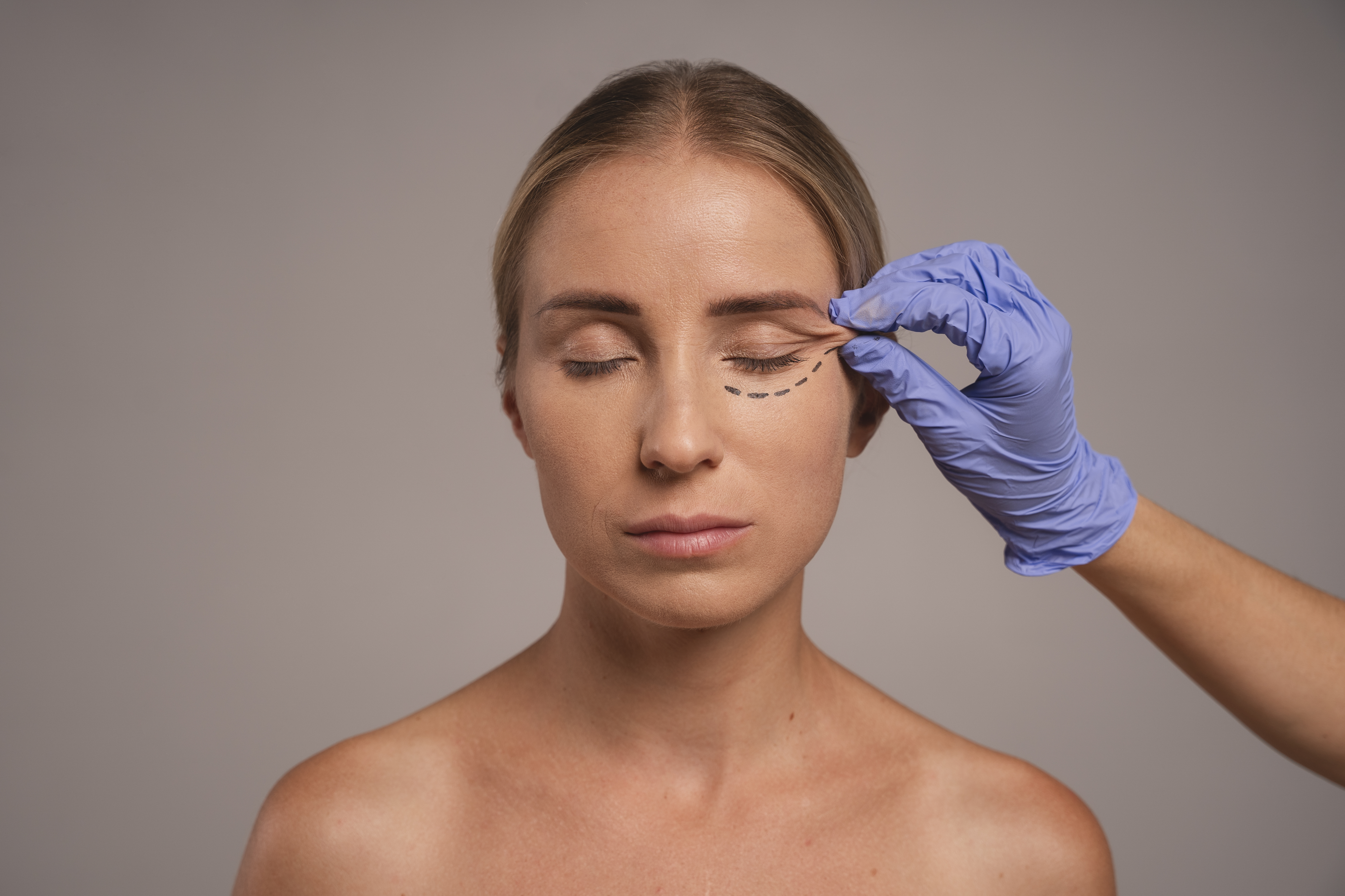 Sua pele pode estar esgotada: veja os sinais do skin burnout e como tratar