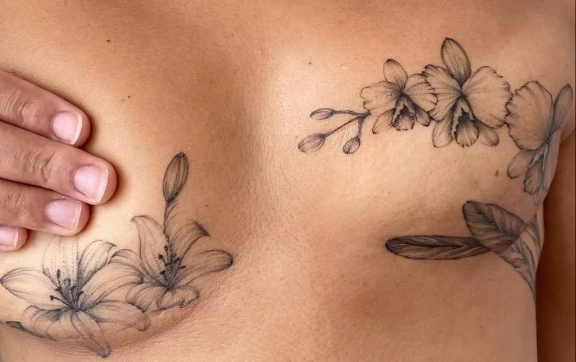 Imagem de um seio coberto de tatuagens após uma cirurgia para a retirada do câncer de mama