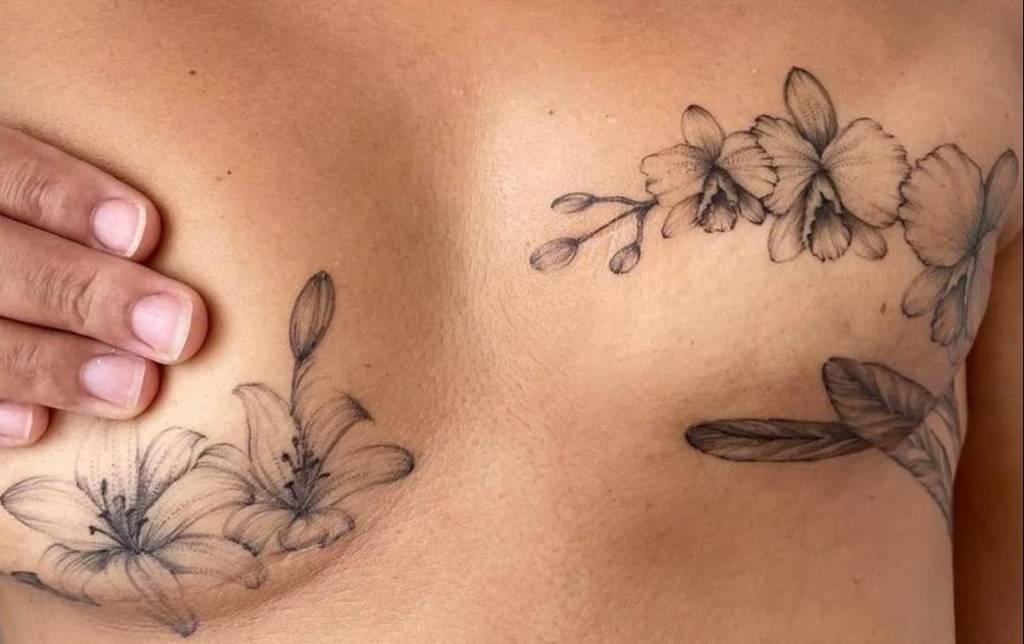 tattoo-truck Imagem de um seio coberto de tatuagens após uma cirurgia para a retirada do câncer de mama