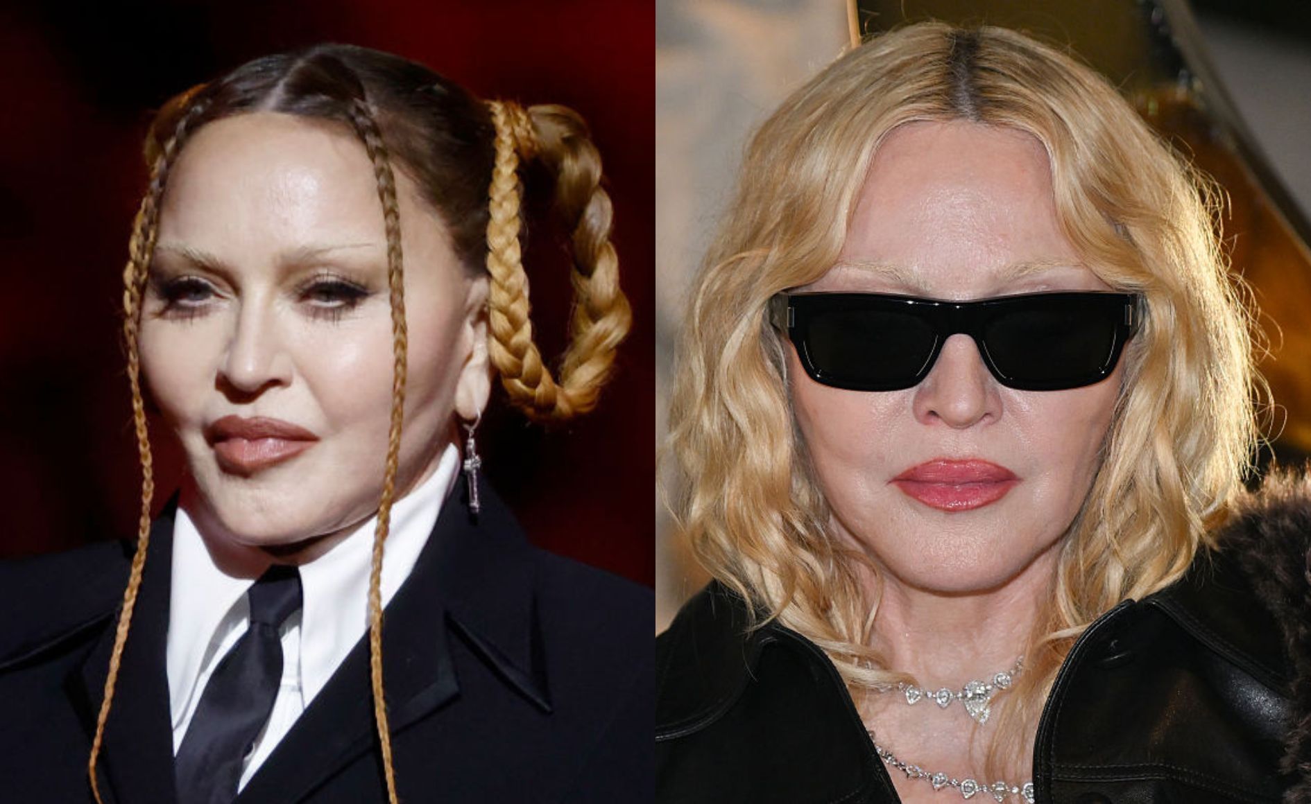 Colagem com duas fotos de Madonna. Uma delas mostra seu rosto inchado, durante o Grammy 2023, e outra é de 2026 e mostra seu rosto desinchado